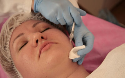 Plasma gel: relleno facial que disminuye las líneas de expresión de forma natural